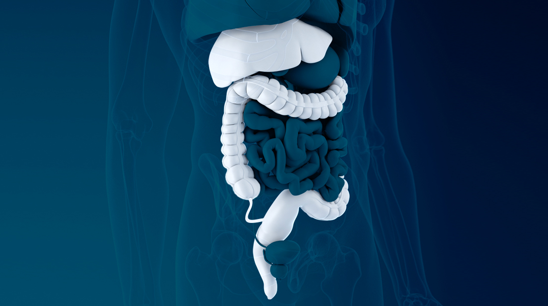 Operasi kanker kolorektal di Singapura