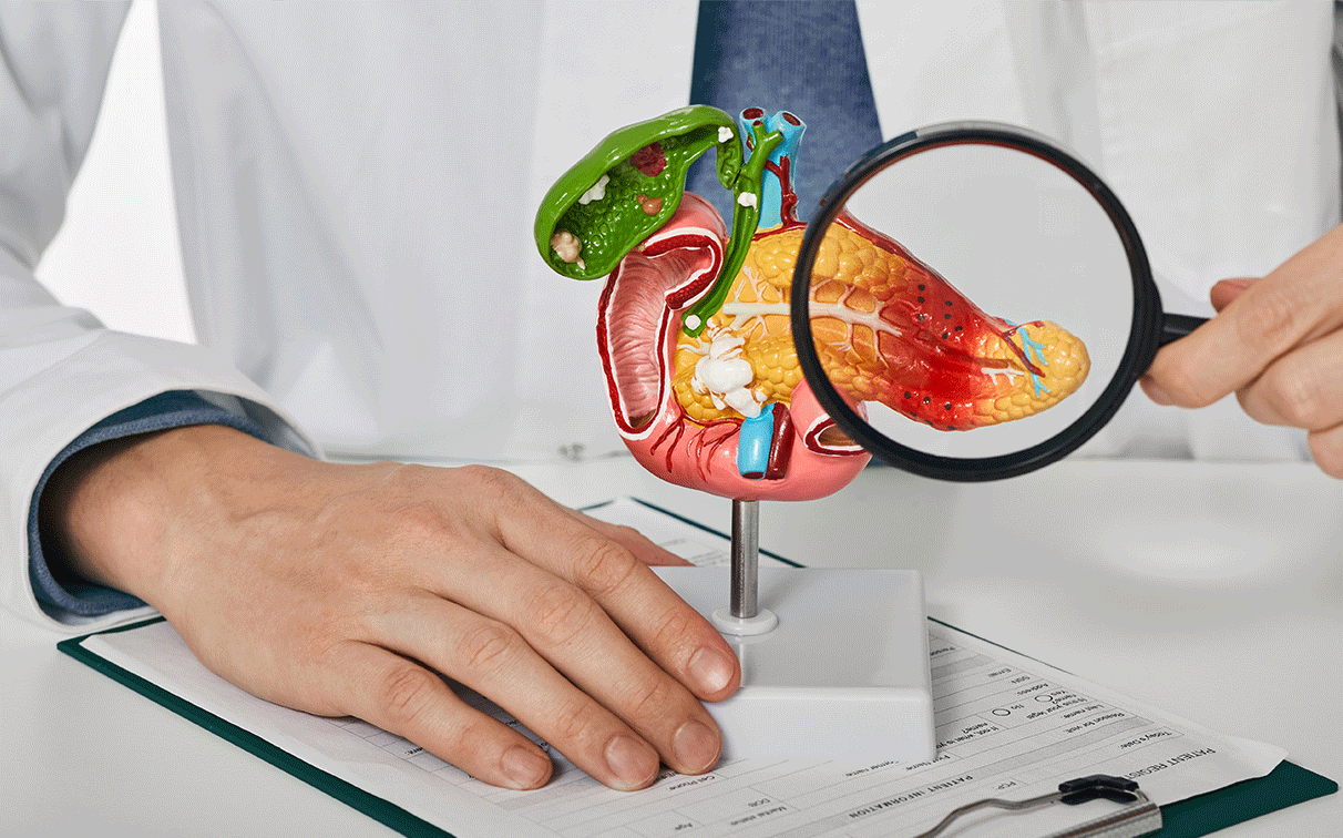 A doctor examining an anatomical diagram of the pancreas