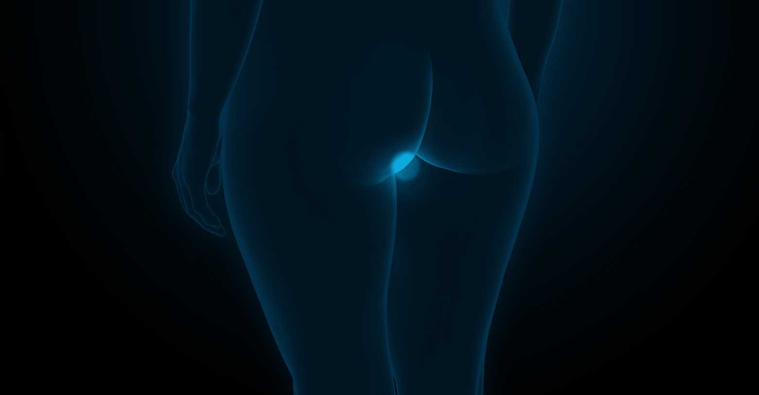 Anal Fissure Treatment Singapore