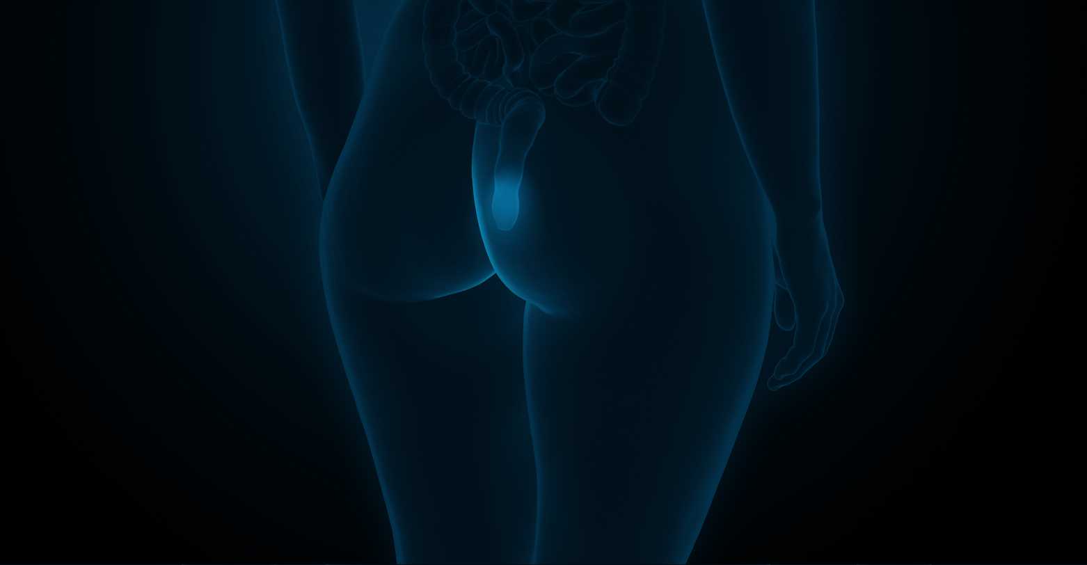 Colorectal Cancer Surgery